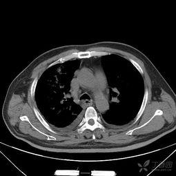 吃瓜网ccgg.ct,带你走进网络舆论的神秘世界